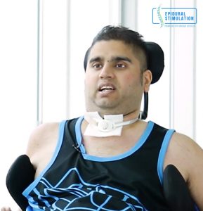 C5-C6 Spinal Cord Injury Patient Randeep - Epidural Stimulation