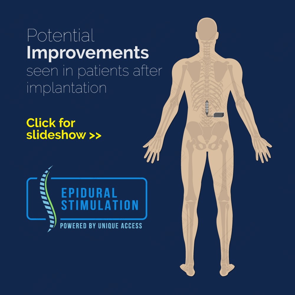 Improvement - Epidural Stimulation