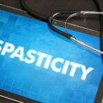 Epidural Stimulation reduces spasticity and spasms in SCI patients - Epidural Stimulation Now